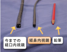 今までの経口内視鏡と経鼻内視鏡の違い